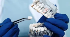 تعرفه‌های ۱۴۰۴ خدمات دندان پزشکی اعلام شد | کامپوزیت هر فک چند ؟