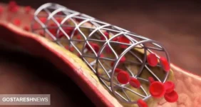 خوش به حالِ بیماران قلبی شد