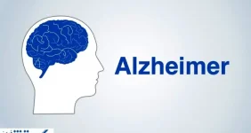 با آزمایش ۳ دقیقه ای آلزایمر را در نطفه خفه کنید !