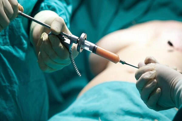 جراحی چاقی آخرین راه است یا اولین انتخاب؟