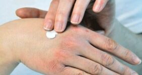 راهکارهای طب ایرانی برای حفظ سلامت پوست و بدن در فصل سرد راهکارهای طب ایرانی برای حفظ سلامت پوست و بدن در فصل سرد