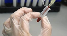 اینجا سلامت خون حرف اول را می زند