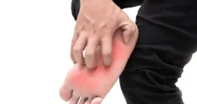 خارش کف پا؛ مشکل کوچک یا نشانه بیماری جدی؟