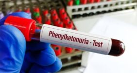 خبر خوش برای بیماران PKU؛ توزیع نان فاقد پروتئین