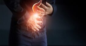 مدیریت رفلاکس در ماه رمضان؛ افطار سبک، معده سالم