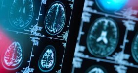 هشدار به بیماران صرعی و آسمی درباره قطع دارو در ایام روزه‌داری